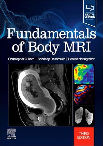 MRI: The Basics: 9781496384324: Medicine & Health Science Books